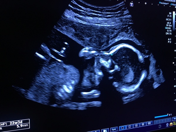 The March-ers 2019 - #7