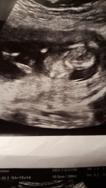 Just for fun, what sex do you think this baby is?