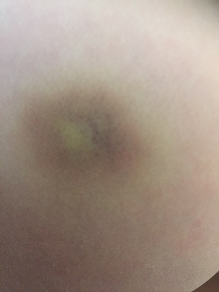 Any idea what this mark on my child is?