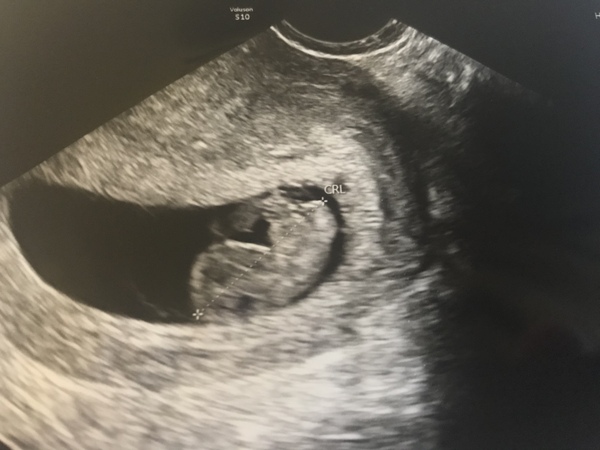 June 2019 - thread 3