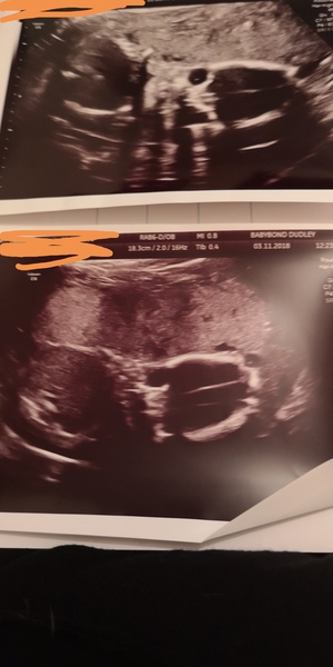Due January 2019 (3rd thread)