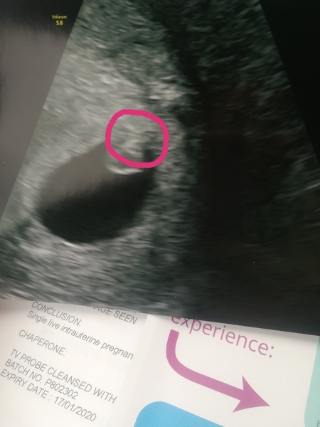 July 2019 Part 4 - Still in the 1st Trimester