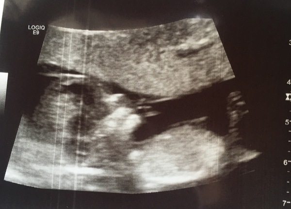 June 2019 - thread 3