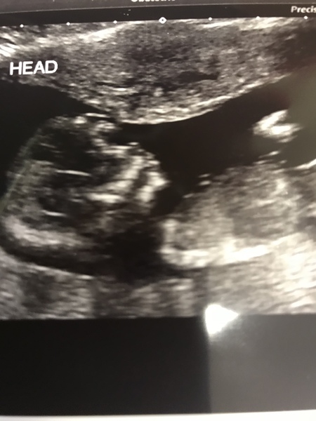 Just got Very first BFP!! Due May 2019 anyone else??