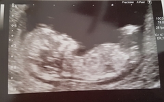 Always said I'd never do this but sex guesses?!