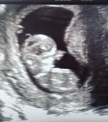 Guesses?! Boy or girl? Tricky one