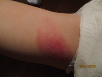 Should I complain to Tesco about this?  (Graphic picture warning)