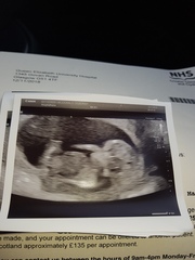 gender guesses please??
