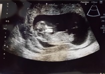 Driving myself crazy!! Boy or Girl?