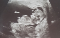 Boy or girl?