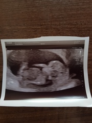 gender guesses please??