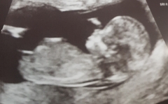 Boy or girl?