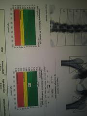 Bit confused about HRT - had an appt today which didn't help