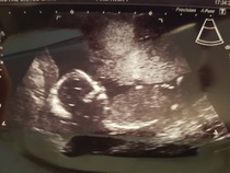 Driving myself crazy!! Boy or Girl?