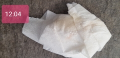 Implantation bleeding or af going to start? (Sorry pics are included)