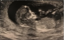 Boy or girl skull - care to guess?!