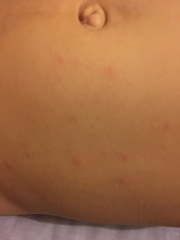 Spots....viral? Allergy?
