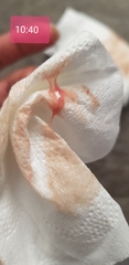 Implantation bleeding or af going to start? (Sorry pics are included)