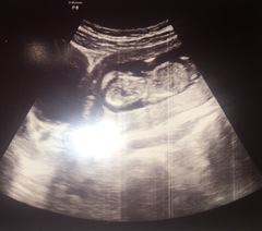 Guesses?! Boy or girl? Tricky one