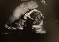 Boy or girl skull - care to guess?!