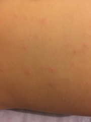 Spots....viral? Allergy?