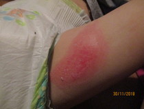 Should I complain to Tesco about this?  (Graphic picture warning)