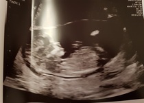 First baby due June 2019!