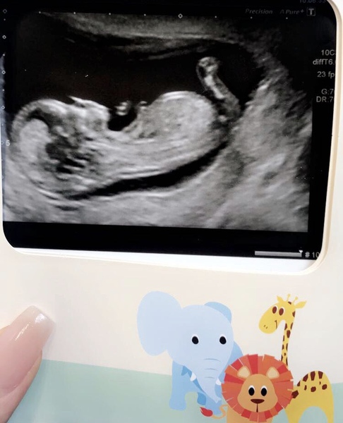 June 2019 Thread 4 - sliding towards 2nd trimester