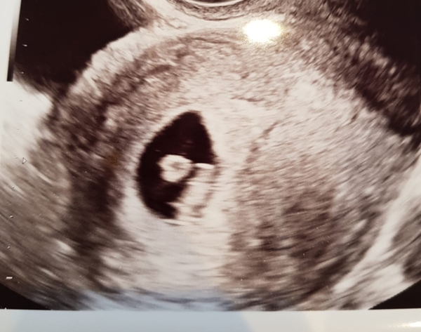 June 2019 Thread 4 - sliding towards 2nd trimester