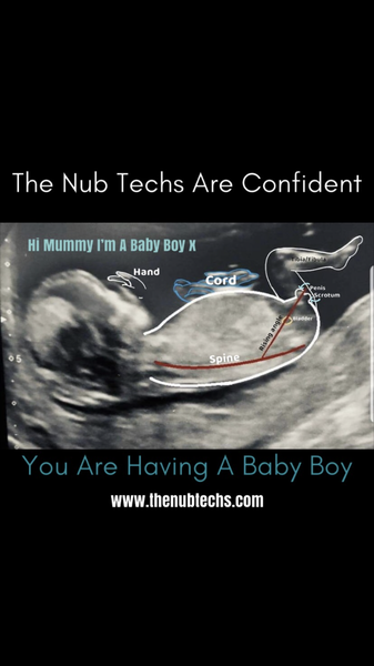 June 2019 Thread 4 - sliding towards 2nd trimester