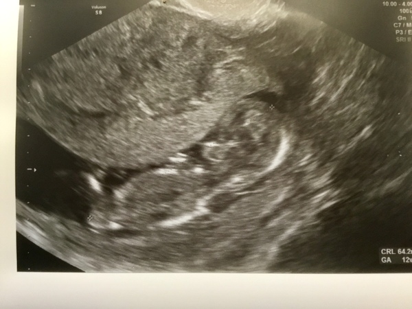 June 2019 Thread 4 - sliding towards 2nd trimester