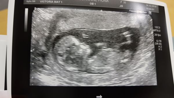 June 2019 Thread 4 - sliding towards 2nd trimester