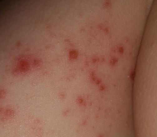 AIBU to think my doctor has got it wrong (with pics)