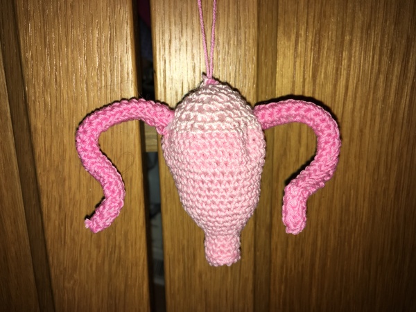 Hysterectomy.