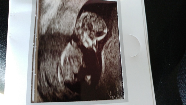 June 2019 Thread 4 - sliding towards 2nd trimester