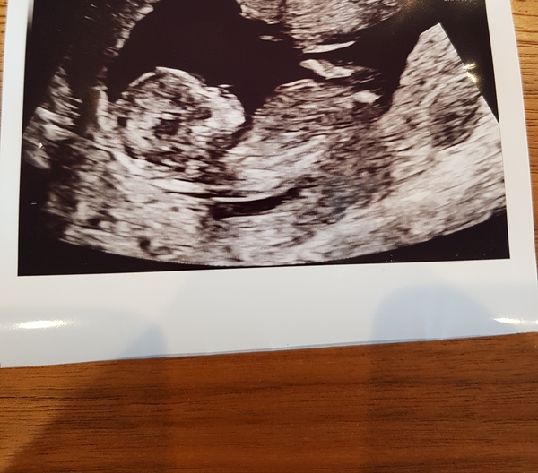 June 2019 Thread 4 - sliding towards 2nd trimester