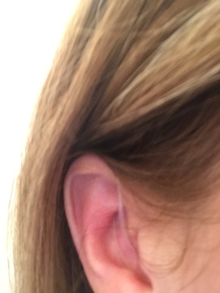 Do you need to go to GP for hearing test?