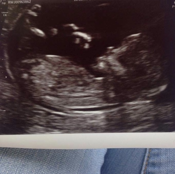 Boy or girl?? Just got fun :)