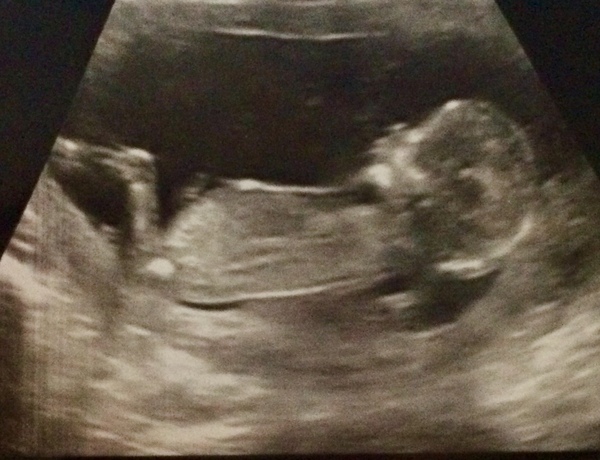 July 2019 - Part 5!!