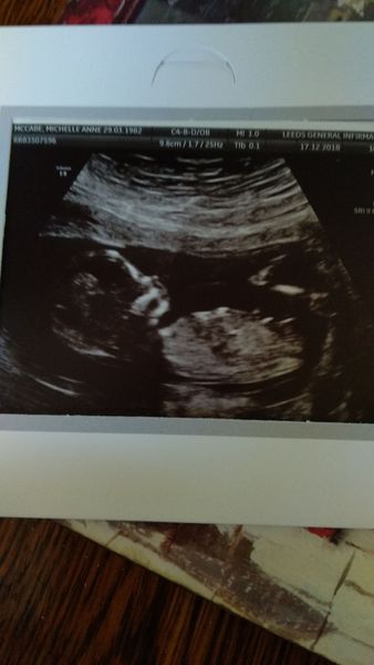 June 2019 Thread 4 - sliding towards 2nd trimester