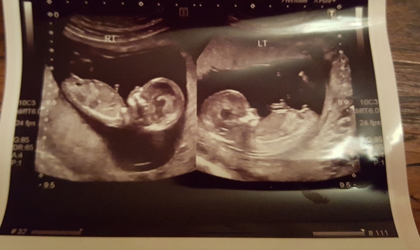 June 2019 Thread 4 - sliding towards 2nd trimester