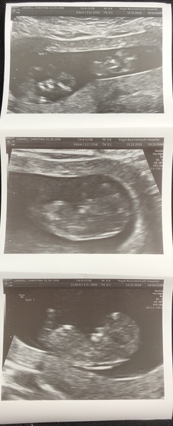 June 2019 Thread 4 - sliding towards 2nd trimester