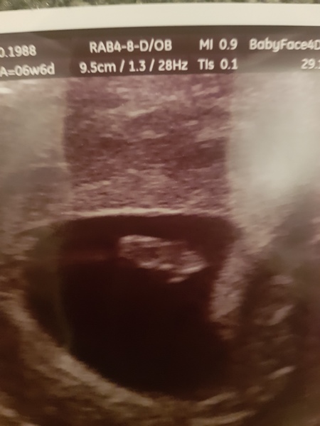 2 week wait - Thread 2