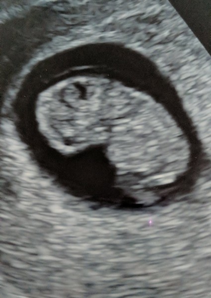 July 2019