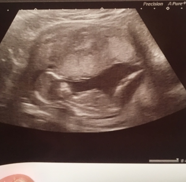 First baby due June 2019!