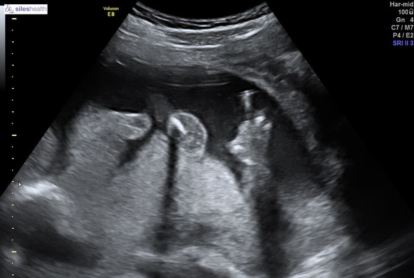 Due May 2019