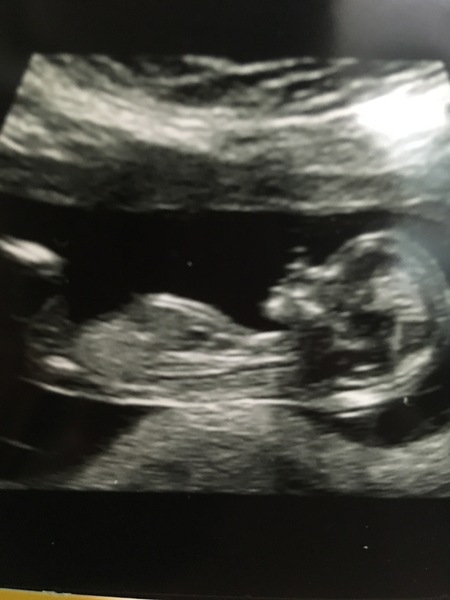 June 2019 Thread 4 - sliding towards 2nd trimester