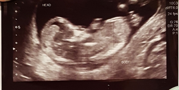 Catching up with those from TTC thread