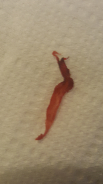 Looking for advice, what is this I passed today? Uterine lining? ***WARNING GRAPHIC PHOTO**