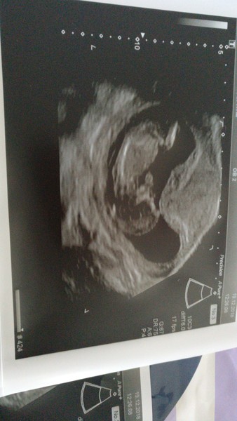 June 2019 Thread 4 - sliding towards 2nd trimester